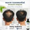 U hair premium anti hair loss shampoo (200ml.) 1 ขวด